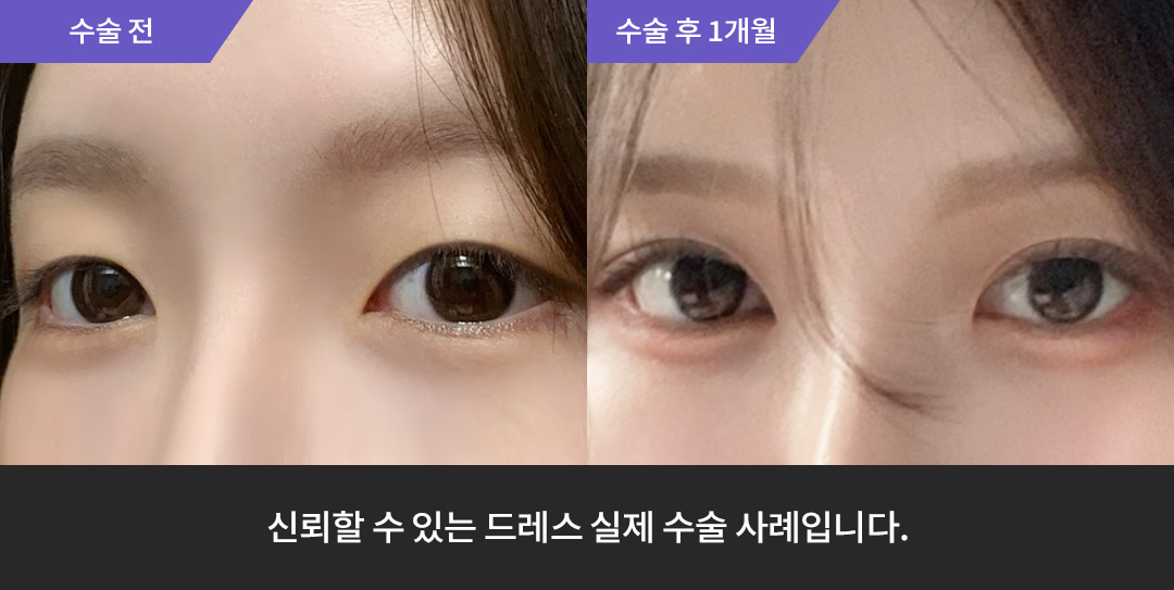 Before & After 0