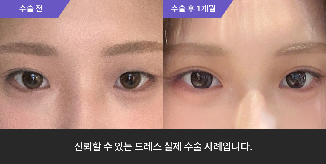 Before & After 1