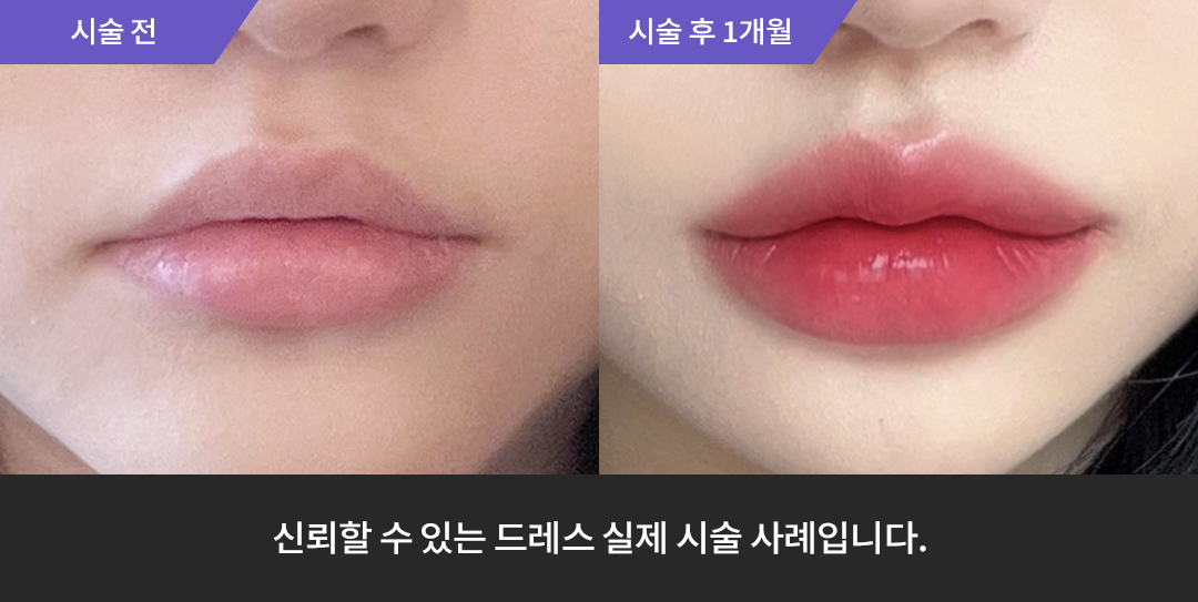 Before & After 4
