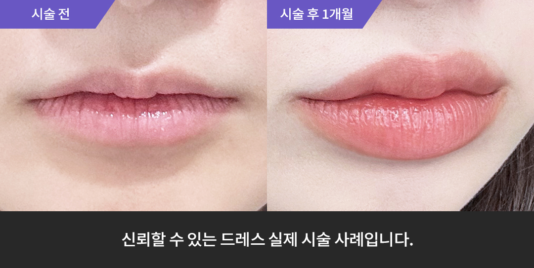 Before & After 5