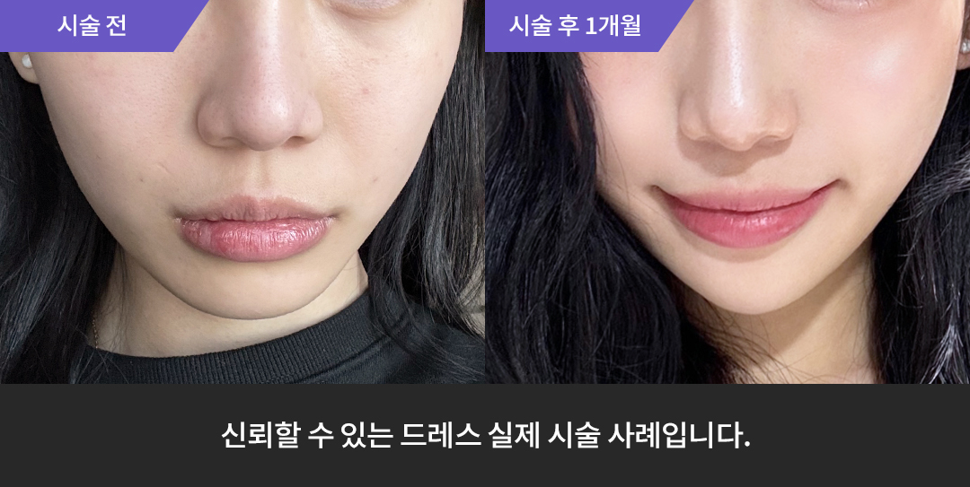 Before & After 9
