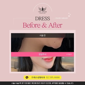 암살주사