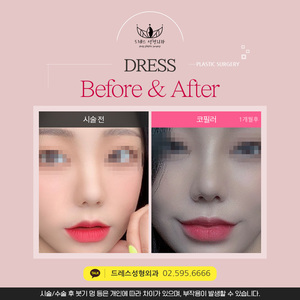 코필러