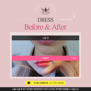 턱필러