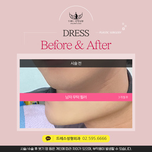남자무턱필러