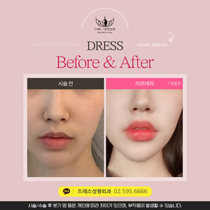 리프테라