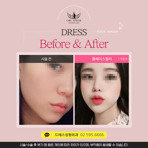 풀페이스필러