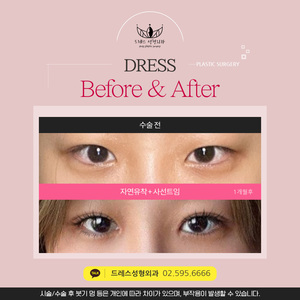 자연유착 + 사선트임