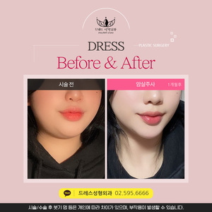 암살주사