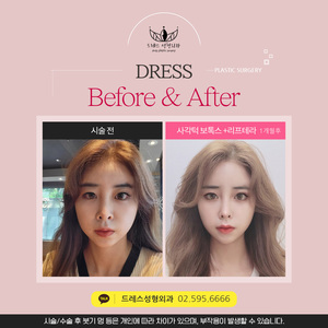 사각턱 보톡스 + 리프테라