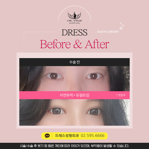 자연유착 + 듀얼트임