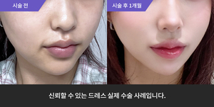 포텐자