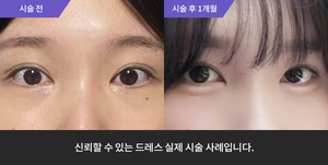 애교필러