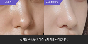 코필러