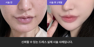 포텐자