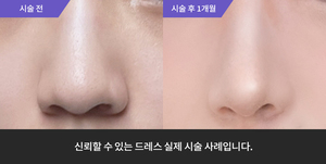 하이코