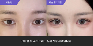 애교필러