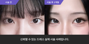 애교필러